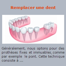 Remplacer une dent